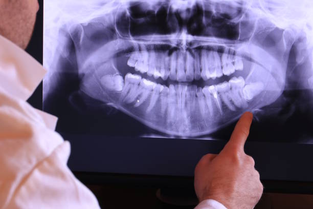 Best Broken or Cracked Tooth Emergency Dentist in Gilbert, IA