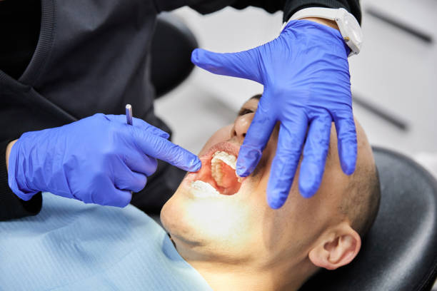 Best Emergency Dentist for Lost Fillings or Crowns in Gilbert, IA