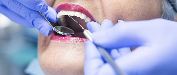 Best Emergency Dentist for Lost Fillings or Crowns in Gilbert, IA